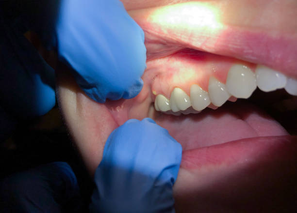 Best Emergency Dental Care for Trauma or Injury in Queens Gate, PA